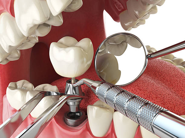 Best Walk-In Emergency Dentist in Madison, SD